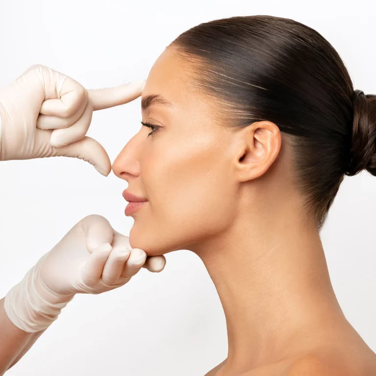 Perfiloplastia 11 copia